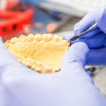 تركيب الأسنان الصناعية